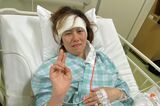 32歳の女性が語る、小学生で宣告された『神経線維腫症2型』の闘病生活「楽に生き…