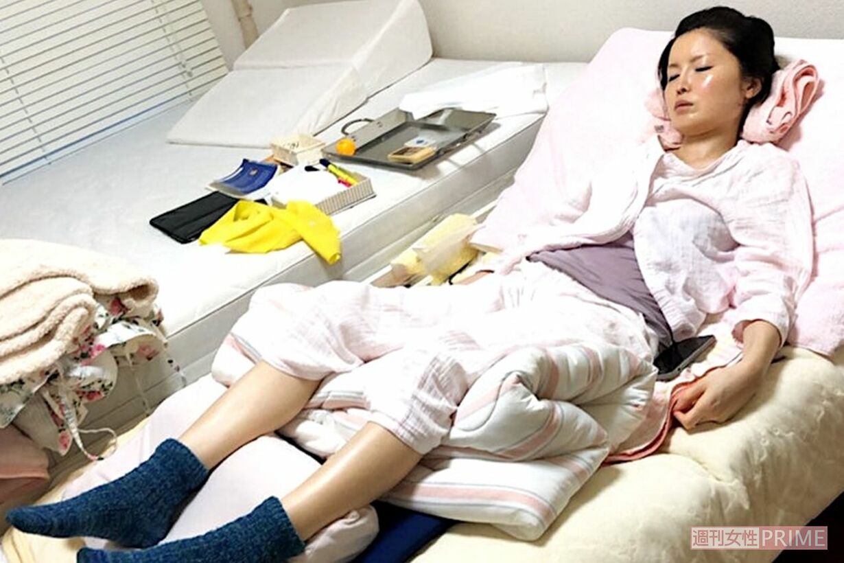 乳がんステージ4のYouTuberミミポポ「腫瘍が皮膚から飛び出してきた」34歳で余命宣告から5年「大きな学び」