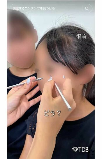 夏休み中の10歳の女子小学生が二重整形を受ける様子を動画投稿したTCB東京中央美容外科・新宿東口院の医師（TikTokより）