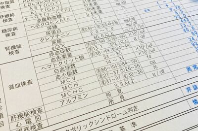 健康診断・人間ドック、医者が言わない「検査の基準値」ウソ・ホント、“正しい検査”なんてほとんどない!?