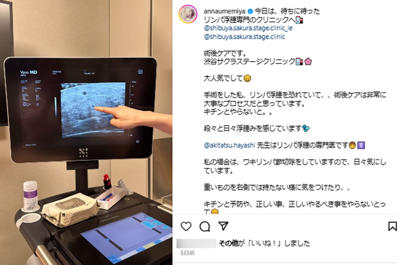 がんの術後リンパ浮腫治療を得意とするクリニックに通い、むくみをケア。「病院に紹介してもらい、やっと専門のクリニックに出会えました」梅宮アンナ公式Instagram（@ annaumemiya）より。