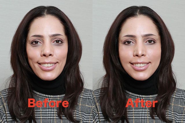 これがフィフィの整形シミュレーション、ビフォー・アフター！