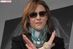 XJAPANのYOSHIKI。“首のコルセット”までアニメでは再現されていた