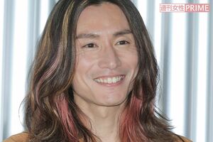 SUPER EIGHT・安田章大の近影が衝撃ビジュアルで「個性的すぎてビビる