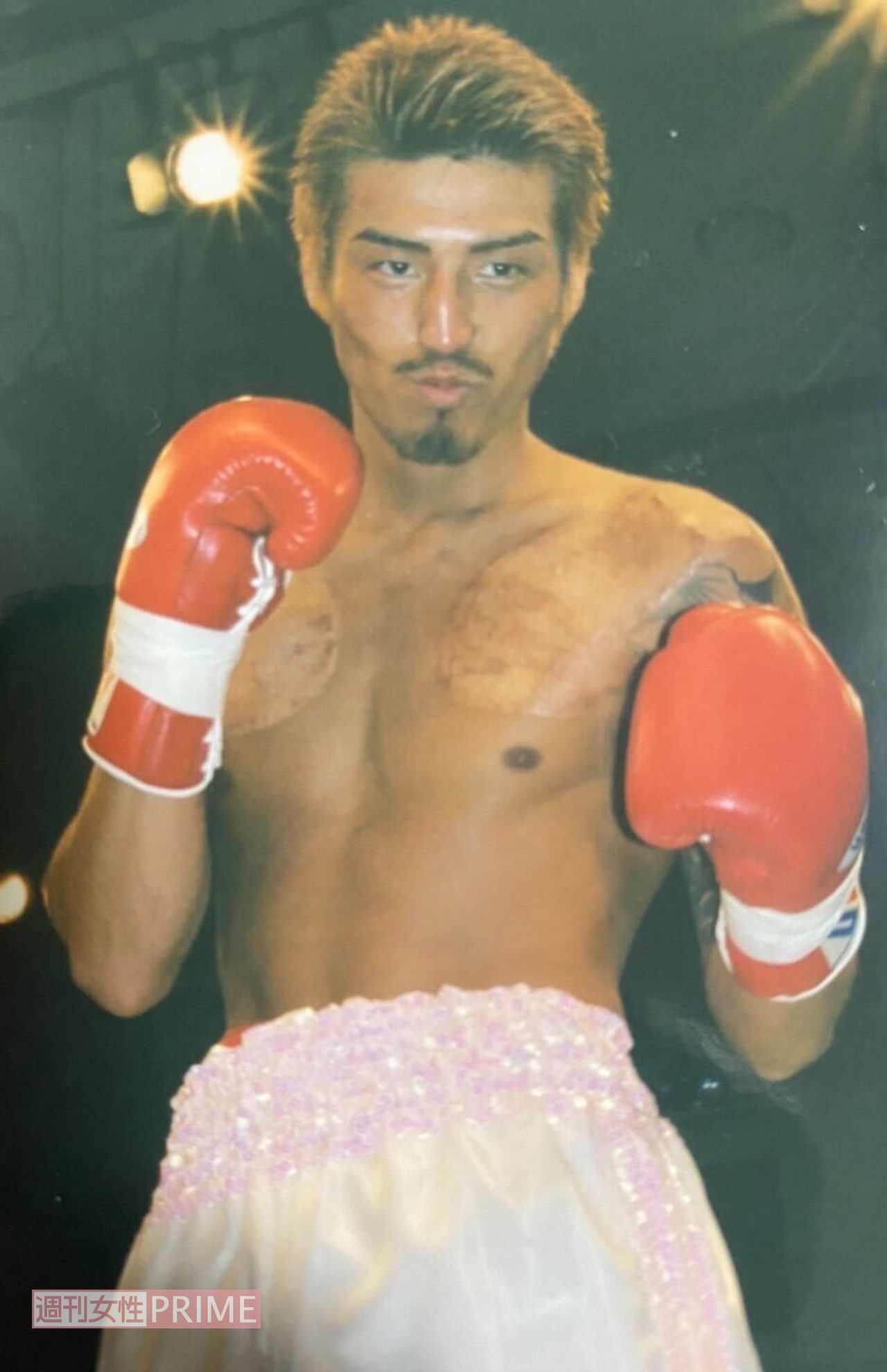 現役時代の大嶋さん。胸部は入れ墨を消した痛々しい後が残る