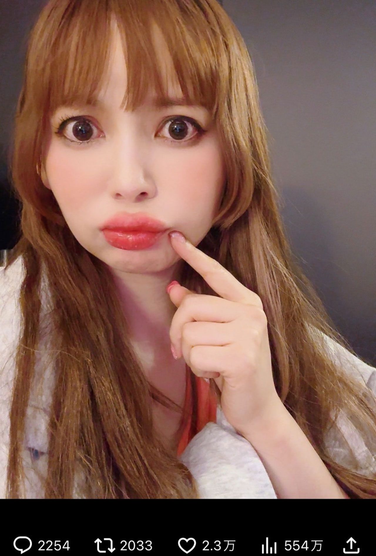 唇が痛々しく腫れ上がっている（中川翔子のXより）