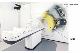 エレクタユニティは、高精度のMRIを搭載し、がんを直接見ながら放射線照射が可能。周囲の臓器への影響が少ないため身体にやさしい。寝ている間に治療完了、膵臓がんなどの消化器官近くのがんにも適用