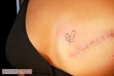 50歳で乳がんが判明し左乳房を全摘手術、ランジェリーショップ店員が「より自分の身体を愛したい」と52歳で…