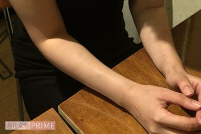 「不倫はクソ」から一転、不倫へ落ちた背景に“父の不在と抜毛癖”――洋子の場合〈下〉