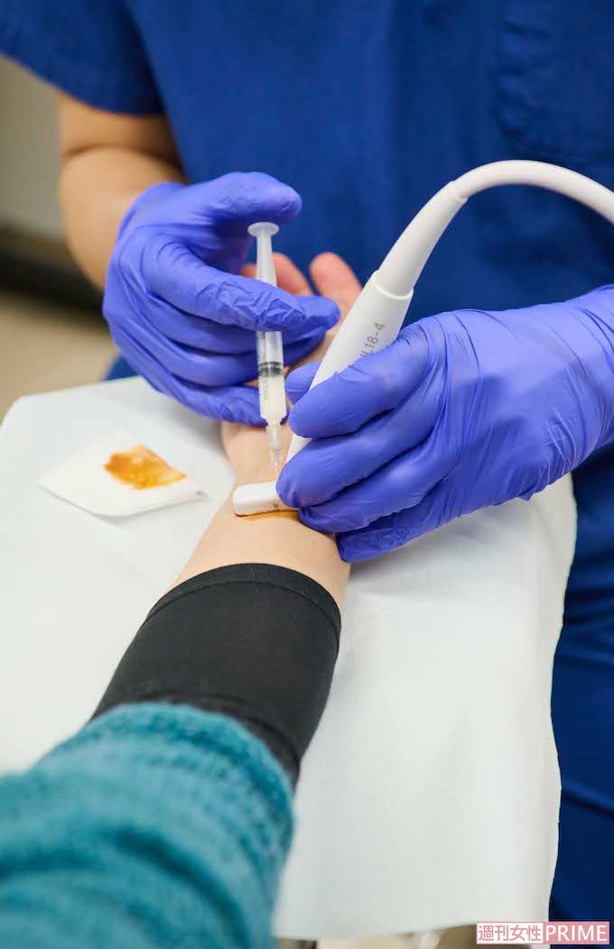 奥野祐次先生「では始めます。チクッとしますよ」