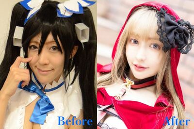 「麻酔から目覚めると頼んでもいない歯科矯正を…」整形総額2600万円のコスプレイヤーが語る整形の現実