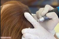 “頭皮にお絵描き”で薄毛カバー！　40代女性編集者が体当たりレポート「韓国ヘア美容」の驚くべき効果と専…