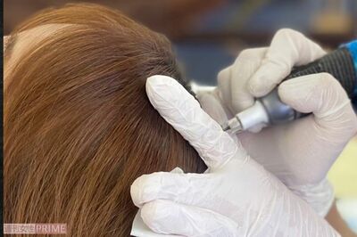 “頭皮にお絵描き”で薄毛カバー! 40代女性編集者が体当たりレポート「韓国ヘア美容」の驚くべき効果と専…