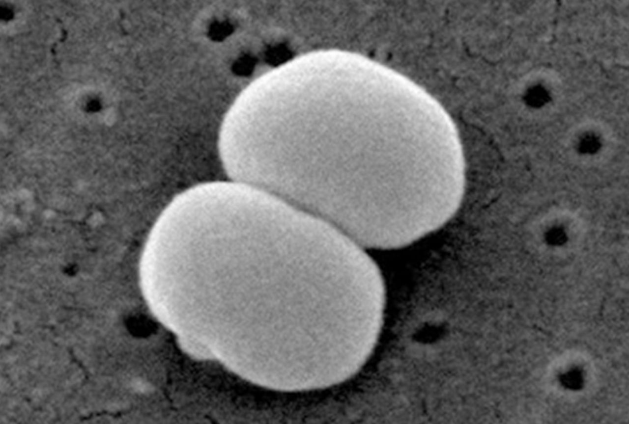 美肌菌の大きさは、1マイクロメートル（1mmの1000分の1）。肉眼では目視できないけれど、存在している。(C) CDC, Janice Carr　