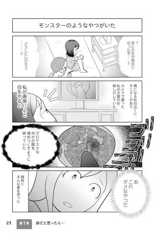 モニターに映し出されたくぐりさんの直腸は、まるでモンスターに侵食されているような状態だった