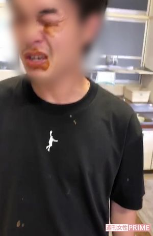 目にもカレーがつけられたX教員