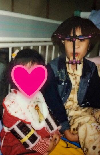 9歳のときには上顎を前に出す、当時最先端の手術を行った。中学に上がると友達はできたが治療を優先した結果、学校を休みがちになり、やがて不登校に