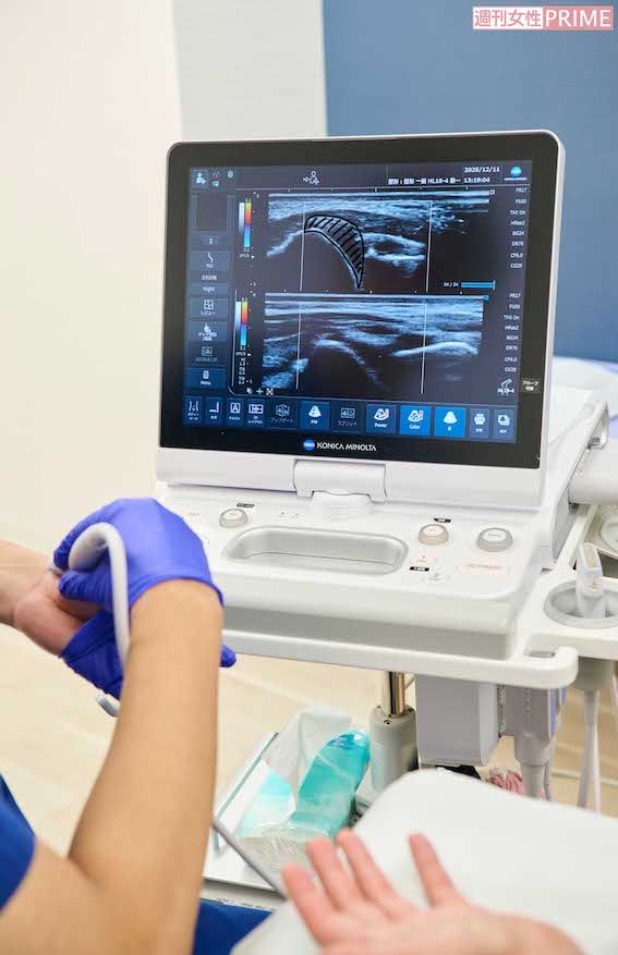 上が柏屋コッコさんの関節。滑膜の腫れが見てとれる。下が先生の正常な関節