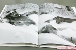 右手の指と手のひらには、傷を隠す白いテープが（撮影／宮澤正明）