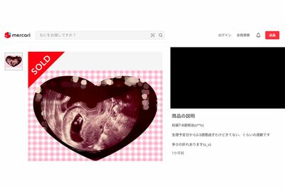 メルカリに“妊娠エコー写真”などの闇深アイテムが大量出品「詐欺以外何に使う？」無法地帯に求められる規…