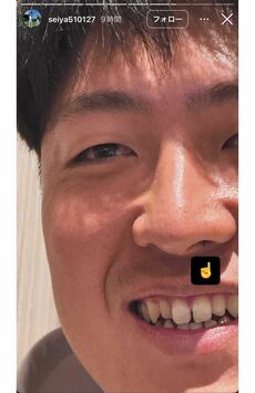 鈴木誠也が公開した岡本和真の“鼻毛ショット”（鈴木のインスタグラムより）