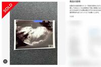 メルカリ「胎児のエコー写真」出品禁止を発表も“ドッキリ検査薬”無規制で続く「無法地帯」対応に疑問噴出