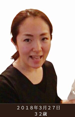 今から7年前、30歳のころのなっちゃん先生。体重は変わらないのに、ややエラの張った四角い顔。口角は下がり、ほうれい線やマリオネットラインも目立つ