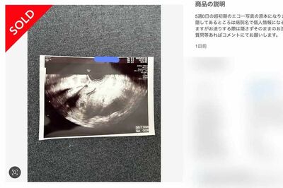 メルカリ「胎児のエコー写真」出品禁止を発表も“ドッキリ検査薬”無規制で続く「無法地帯」対応に疑問噴出