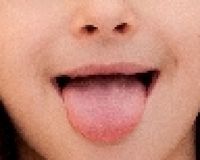 舌の様子を見れば一発でわかる健康状態、6つの着眼点とは