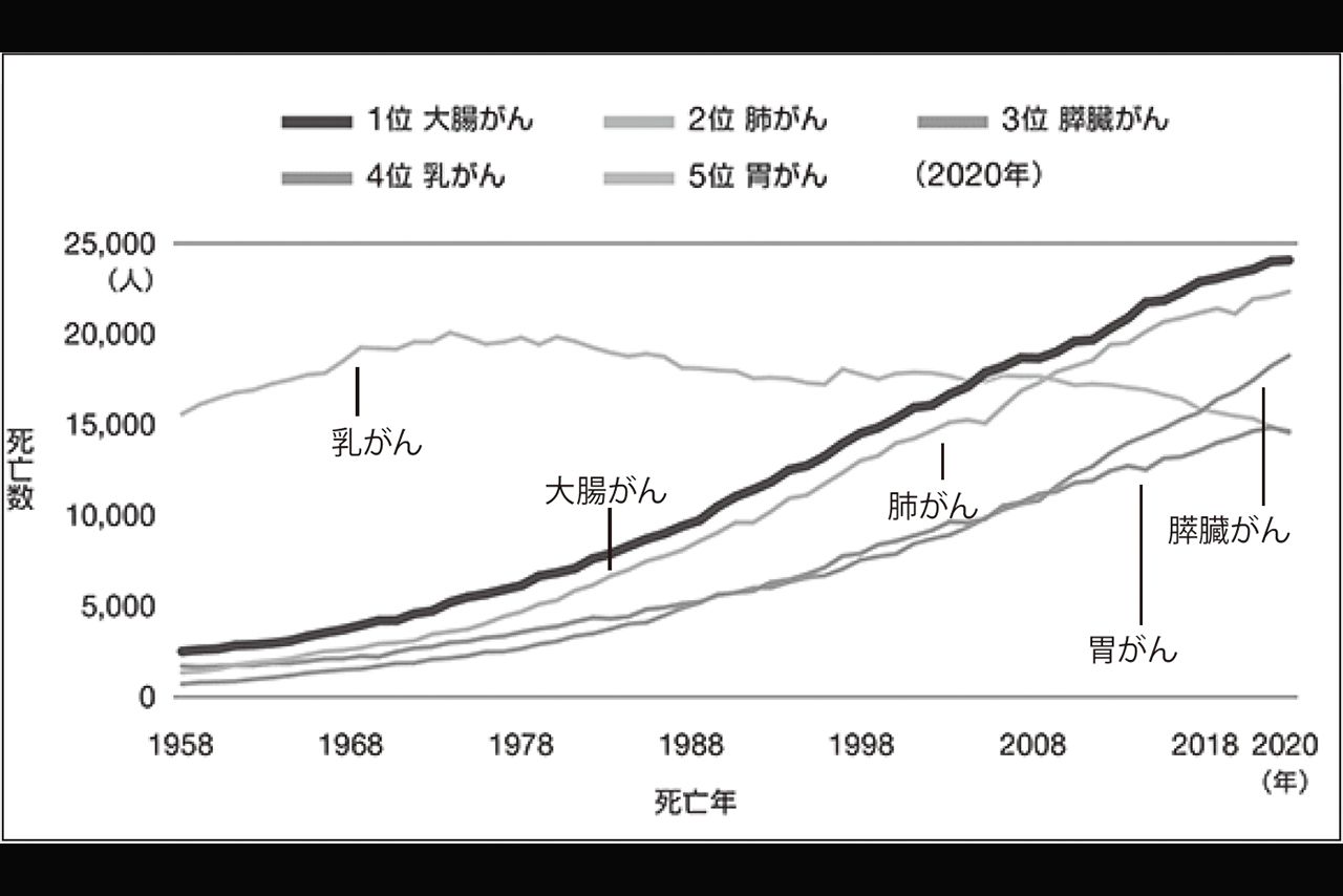 女性が注意すべきがんというと、乳がんや子宮がんを思い浮かべる人が多い。しかし、人口動態調査によれば、2020年の女性のがん死亡原因の1位は大腸がん。男女合わせても近年日本人に急増しているがんのひとつ（出典：国立がん研究センターがん対策情報センター）