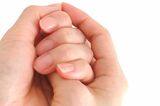「ツメの異変」は身体のSOS信号！ 健康状態は“指先”でわかる『反りヅメ・バチヅ…