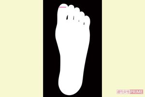 親指に表れる片頭痛線　イラスト／湯沢知子