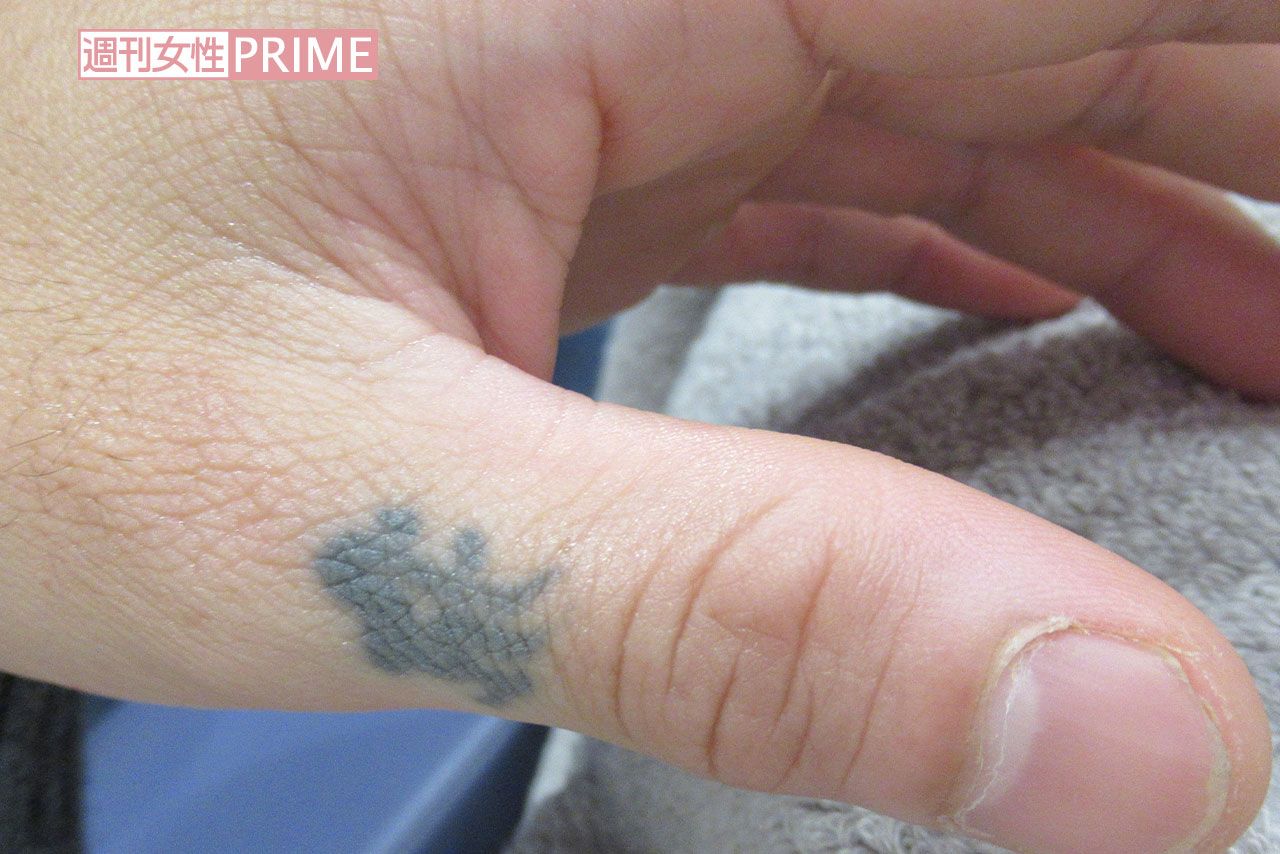 後藤祐樹さんの親指に入っているタトゥー