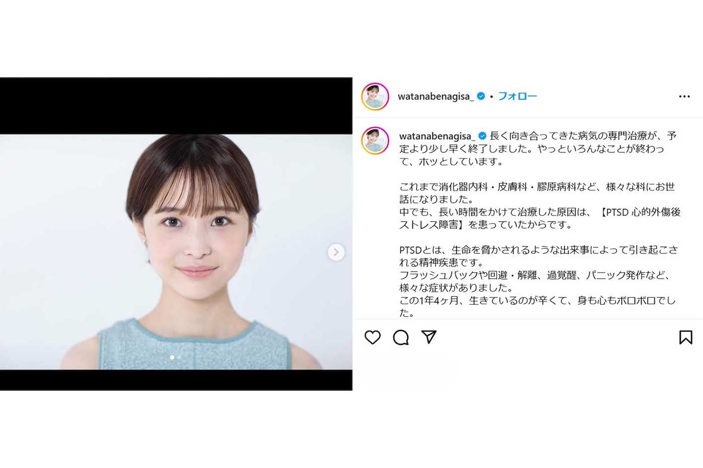 PTSDを患っていたことを公表した渡邊渚（渡邊渚のインスタグラムより）