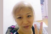 《がん闘病インタビュー》子宮頸がん患者が気づいた“最初の異変”と5度の再発転移からの“奇跡の根治”