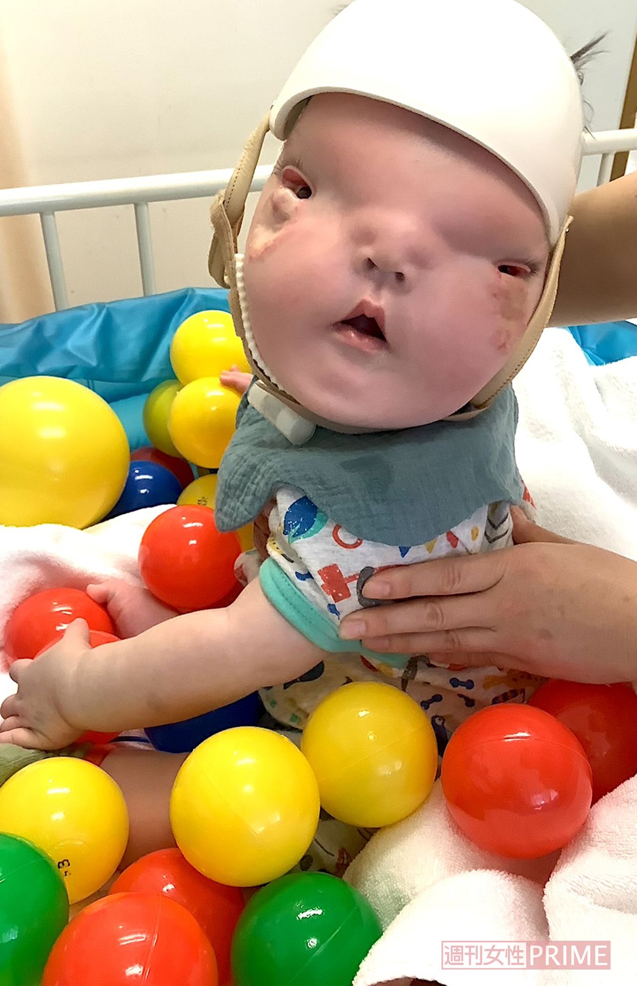 生後9か月のころ。胃ろう手術で入院中のとき、リハビリでボールプールで遊ぶ