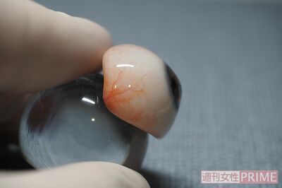 横から見たところ