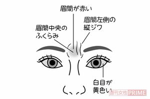 白目の色　イラスト／石崎伸子