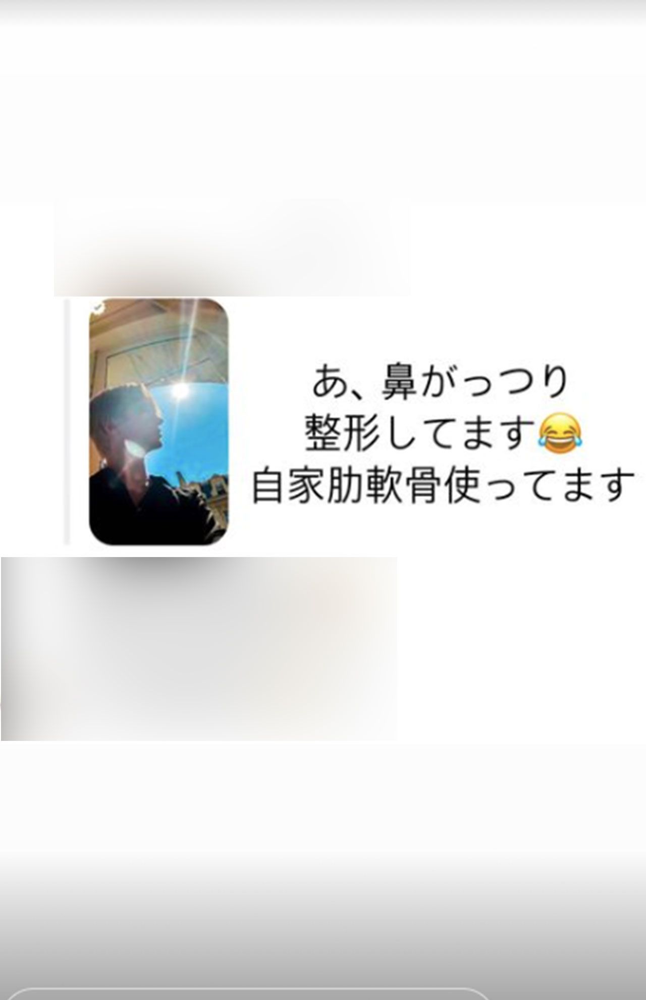 整形していることをSNSで明かしたMatt（本人のインスタグラム、ストーリー機能より）