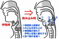 「ムセやすい」は老化のサイン！のどの筋肉を鍛えて「誤嚥性肺炎」を防ぐ