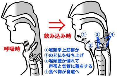 「ムセやすい」は老化のサイン！のどの筋肉を鍛えて「誤嚥性肺炎」を防ぐ
