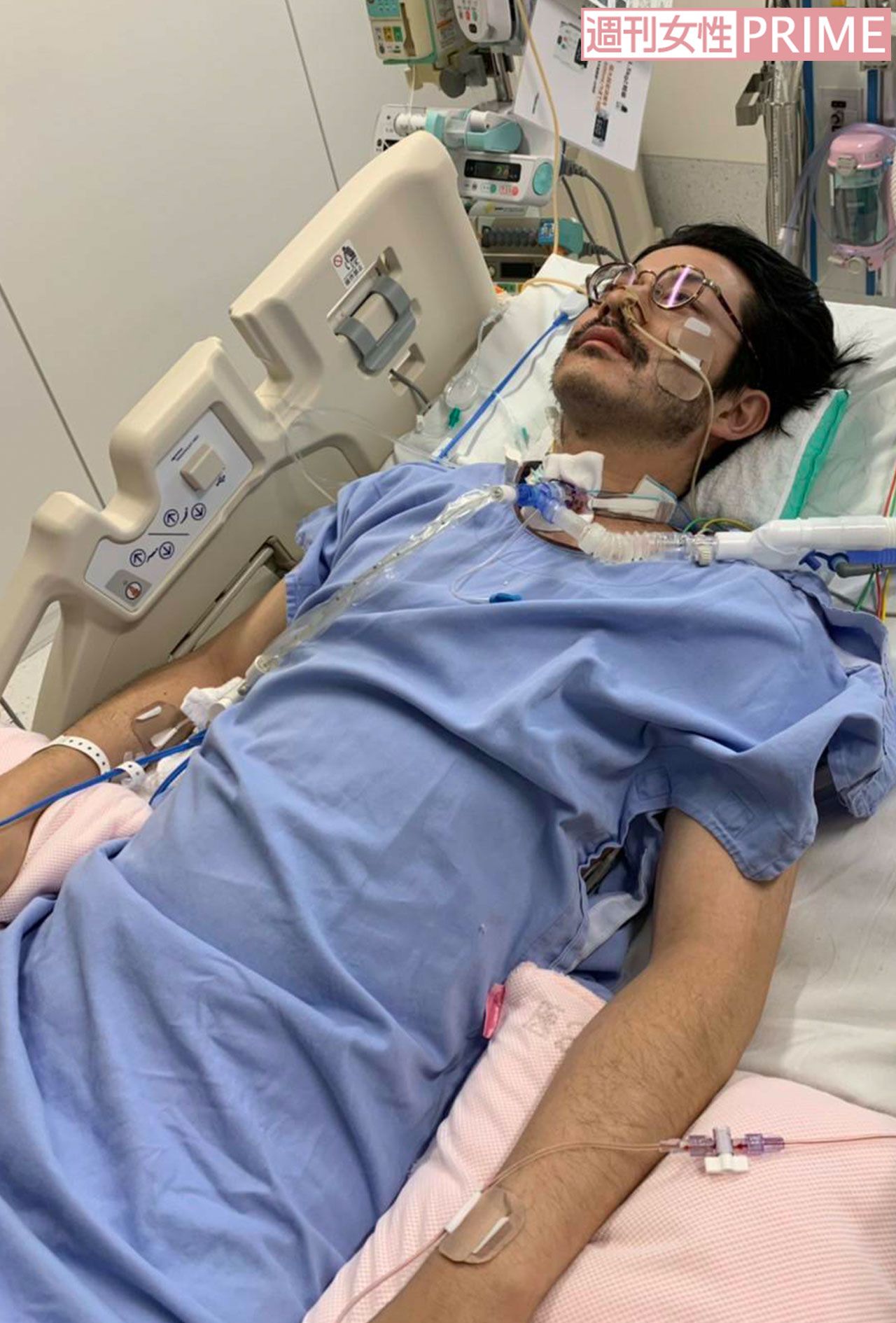 人工呼吸器をつけた俳優の小堀正博さん。人工呼吸器をつけ始めた当初は“意識して”呼吸することが難しかったそう　写真／本人提供