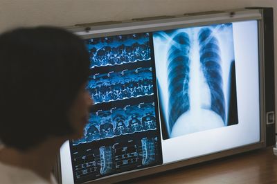 メリットとデメリットを見極め、保険を選ぶことが重要（写真はイメージです）