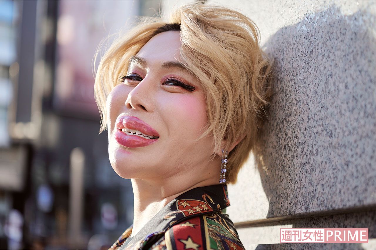 「ヮタクシの歯はジルコニア♪　お直しもすさまじい力がいるの」と語るアレン