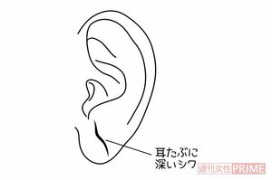 切れそうなくらい深いシワ　イラスト／石崎伸子