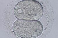 生殖医療に現場医師の本音「持ち込まれた精液が旦那さんのものか確認できない」