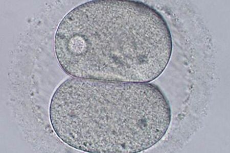 細胞分裂の様子