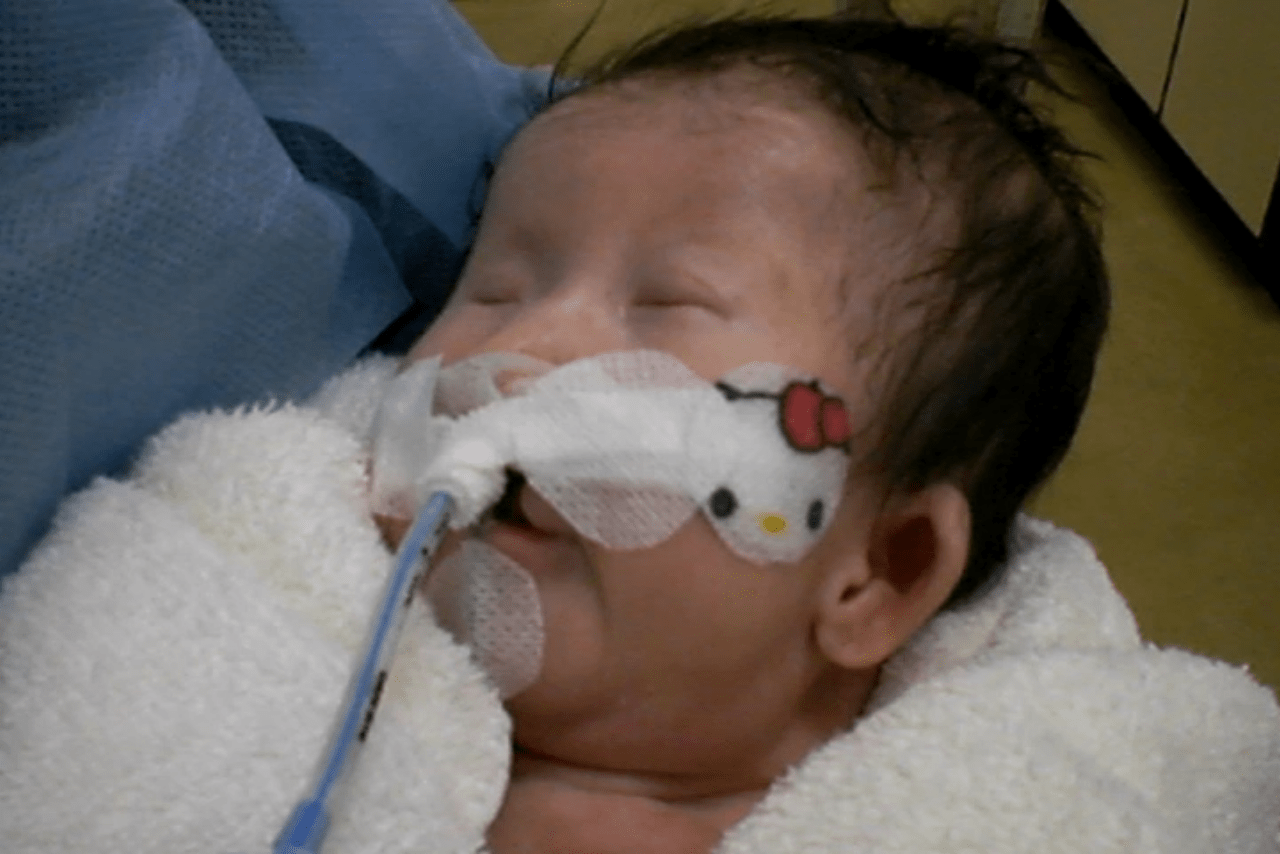 生まれたばかりの晴琉さん。出産後に障害があることがわかり、8か月間入院することに
