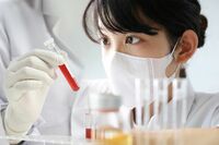 がん発見「腫瘍マーカー検査」の知られざる真実！早期発見は本当にできるのか