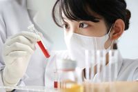 がん発見「腫瘍マーカー検査」の知られざる真実！早期発見は本当にできるのか